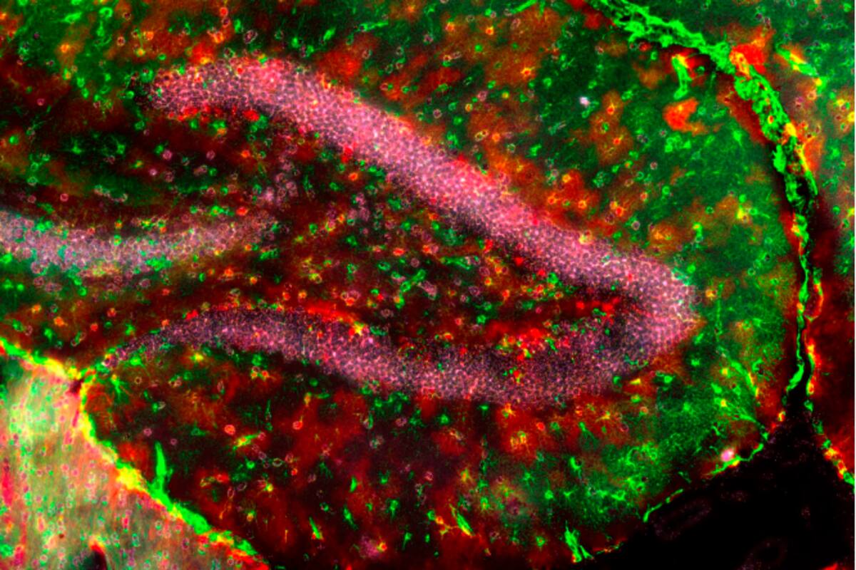 Descubren una célula cerebral clave en la lucha contra el Alzheimer