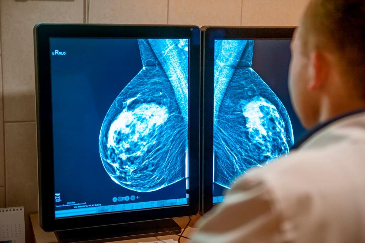Mamografía y ecografía: aliados para la detección del cáncer de mama