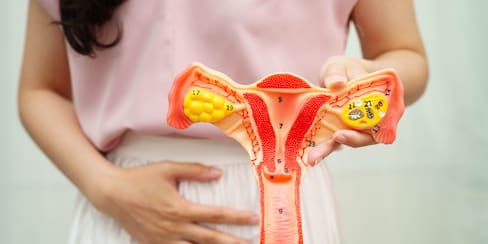 Lo que toda mujer debe saber sobre el cáncer de ovario