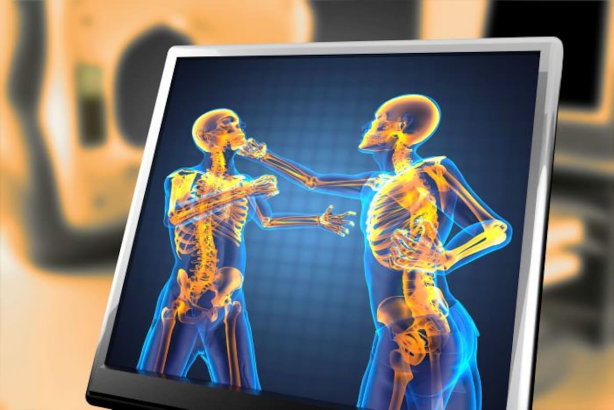 Muchas veces las personas estresadas deciden tronar las articulaciones de su cuello o espalda para aliviar la tensión o masajear un poco la zona y así aliviar el dolor. 123RF