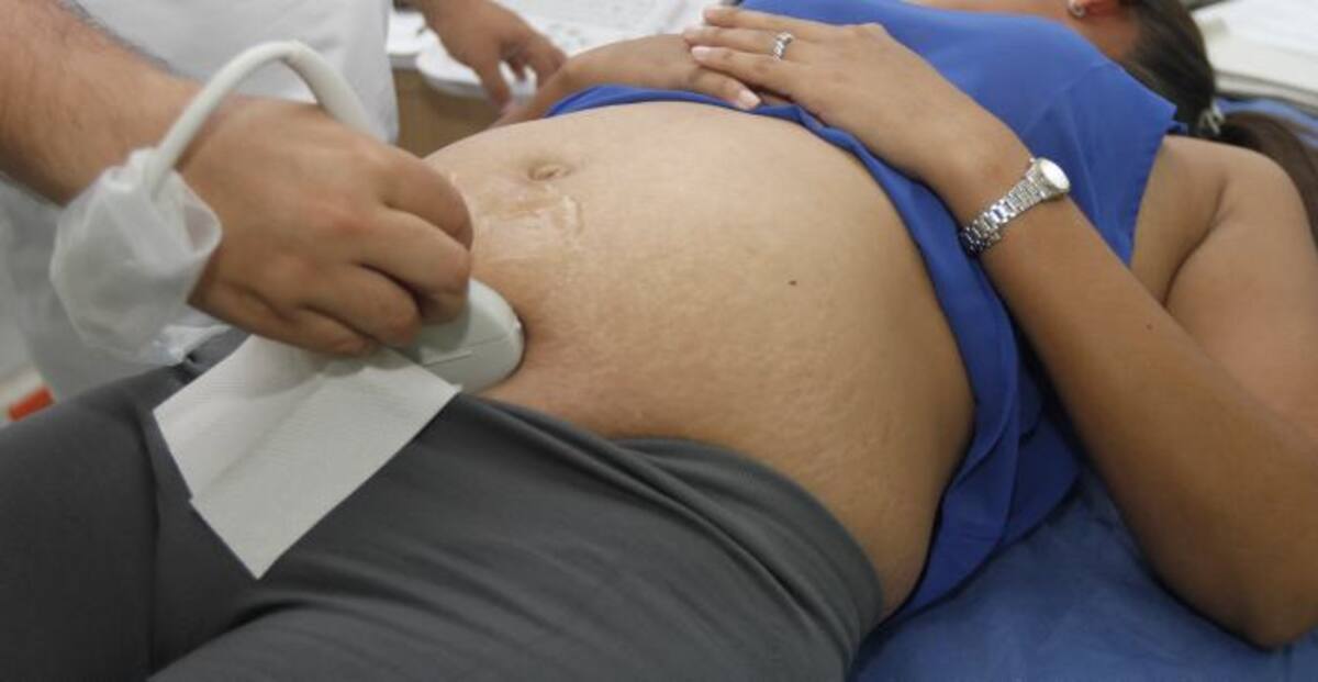 No llevar un adecuado control en el embarazo puede derivar en complicaciones como la subluxación vertebral. ARCHIVO EL UNIVERSAL