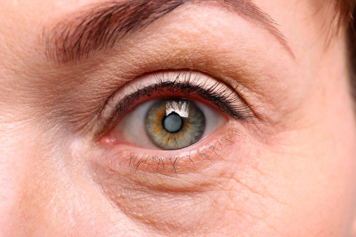 El riesgo de los golpes en los ojos