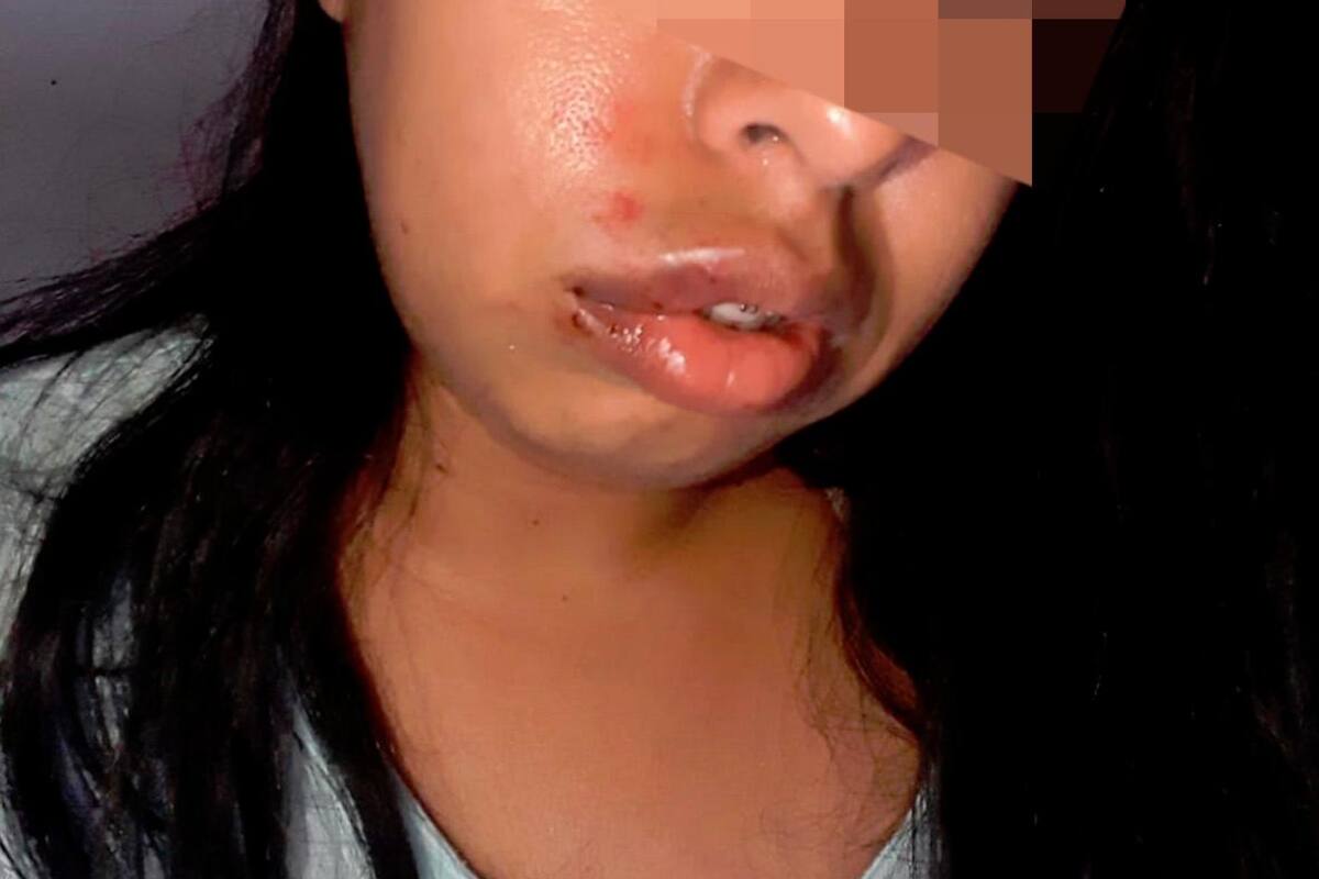 Denuncia a su ex por golpearla en estadero