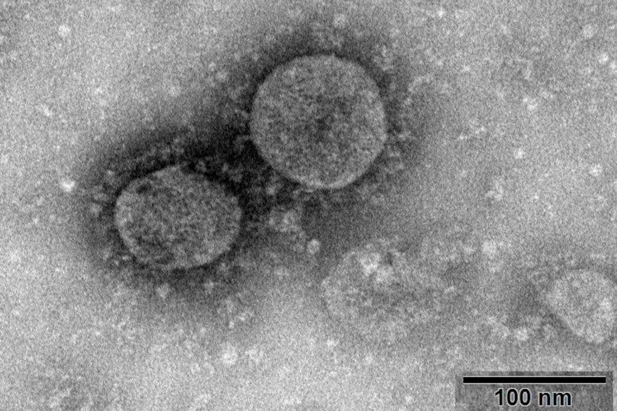 ¿Cómo se contagia y cuál es la letalidad del coronavirus de China?