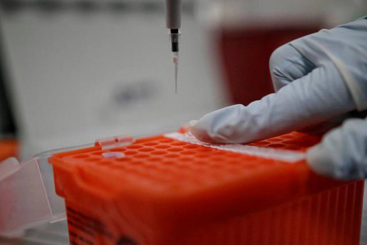 Colombia tendrá dos robots de procesamiento de pruebas del COVID-19