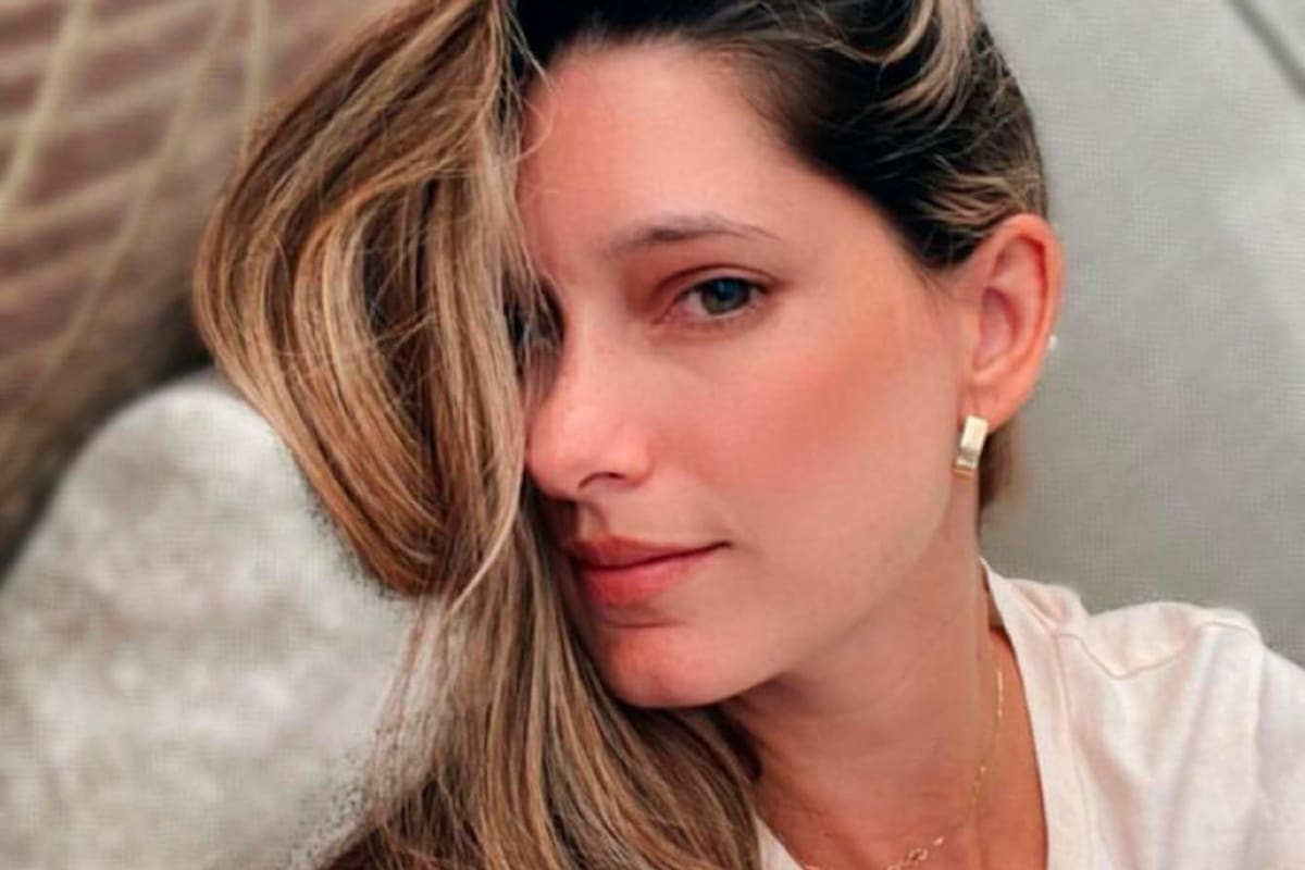 Así es la dermatitis seborreica, enfermedad que padece Daniella Donado