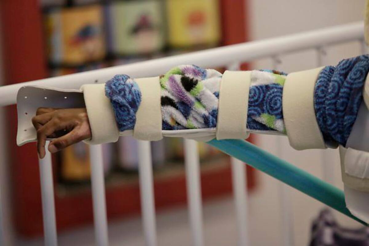 371 personas han resultado quemadas por pólvora en el país