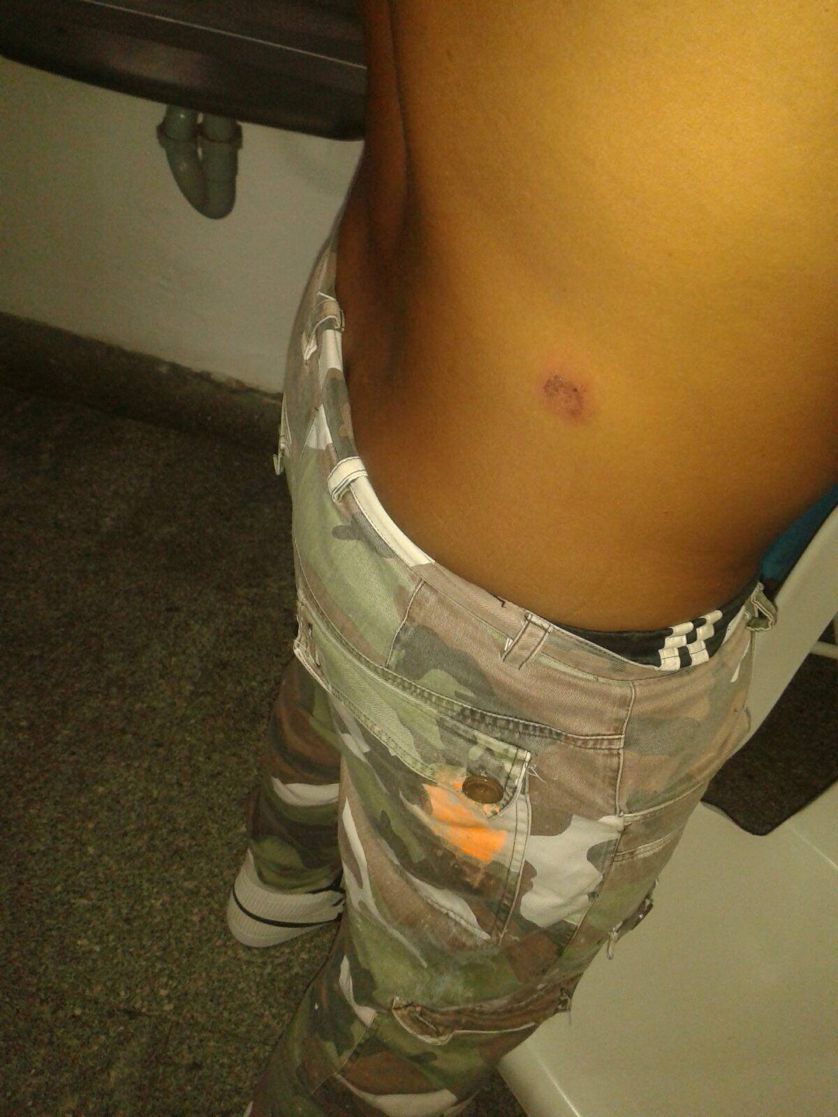 Esta es otra de las heridas que presenta Paredes Pérez, de 43 años. Cortesía Carlos Figueroa