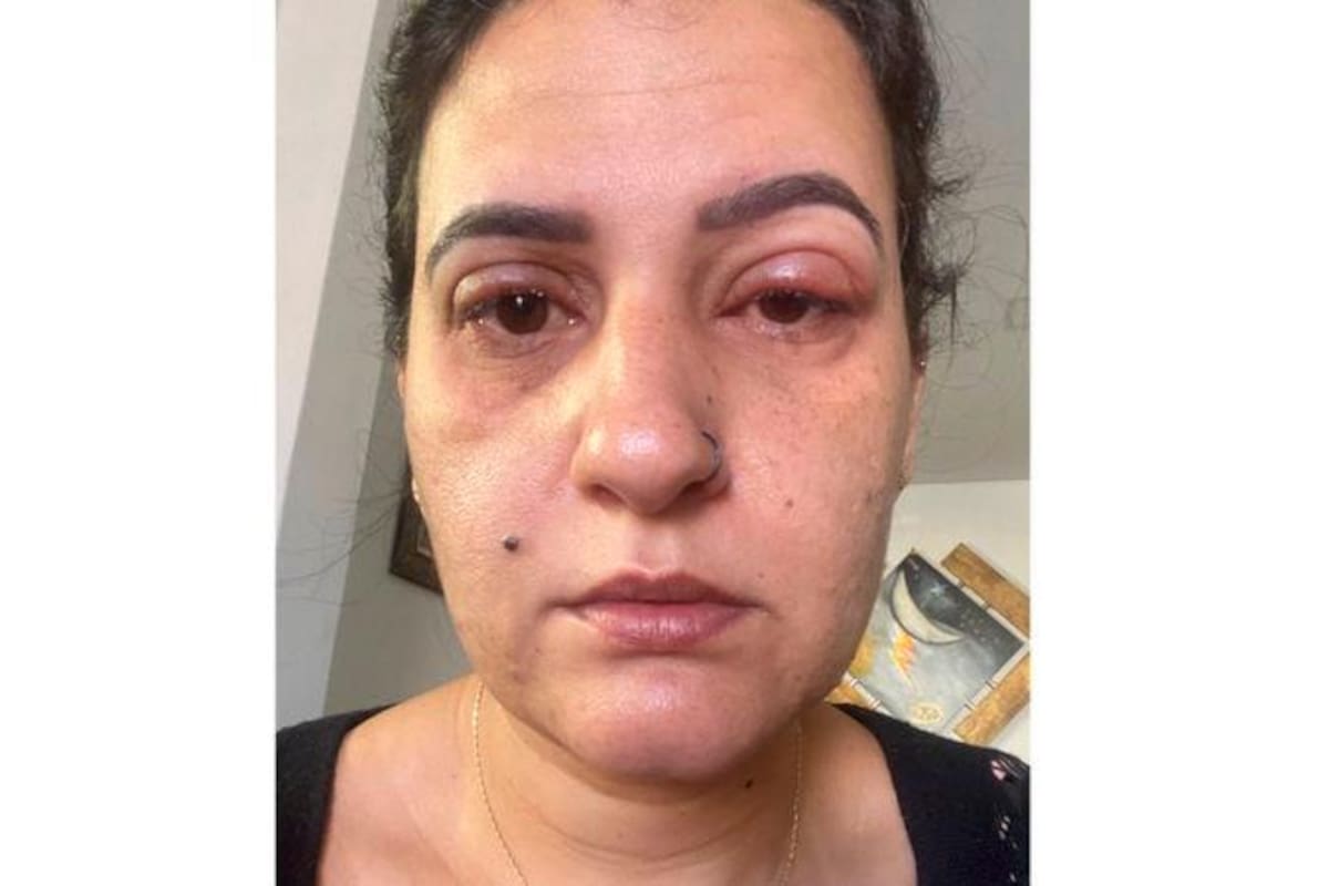 “Acabé en el hospital”: estos son los riesgos de usar pestañas postizas