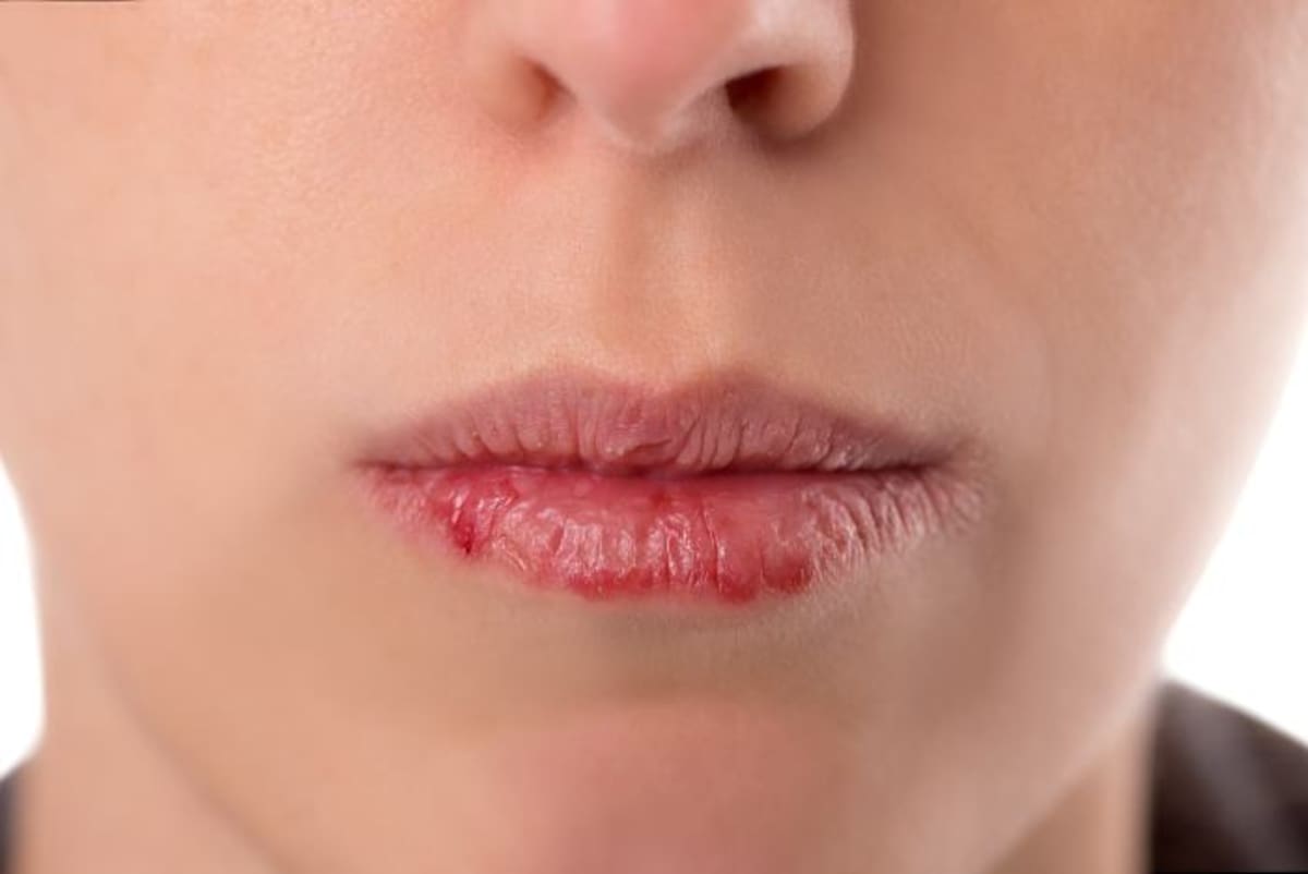 Si usted presenta sensación de sequedad en la garganta, lengua seca, entre otros síntomas, acuda al médico. 123RF.