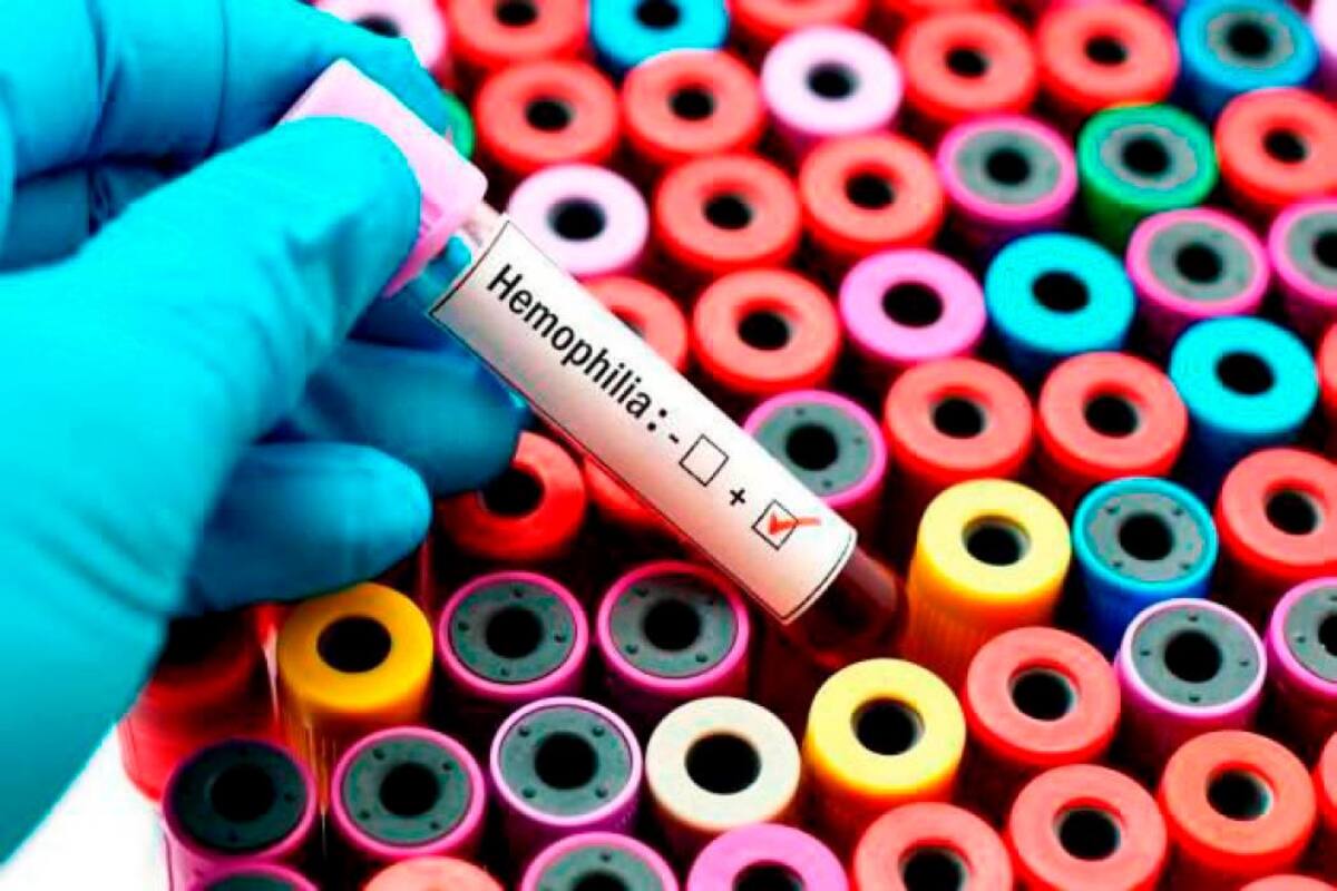 La falta de atención integral y el estigma son grandes retos de la hemofilia
