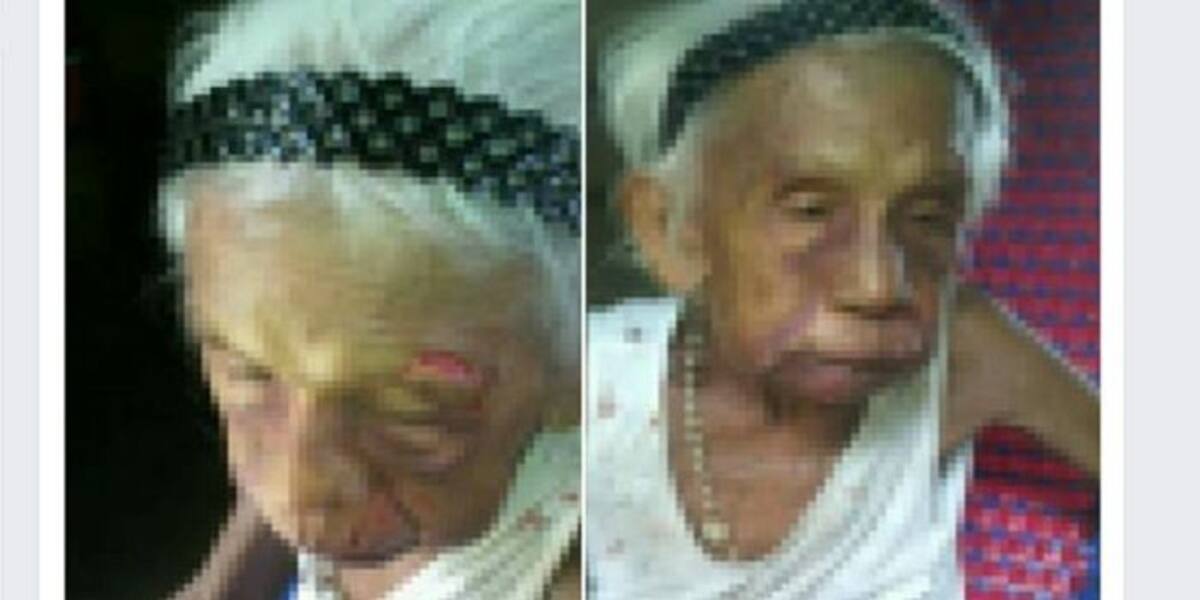 La anciana Ovenicia Martínez, golpeada por su hijo.