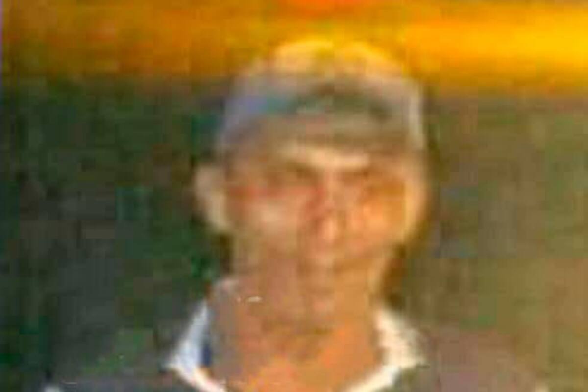 Fallece hombre que había sido quemado con aceite hirviendo