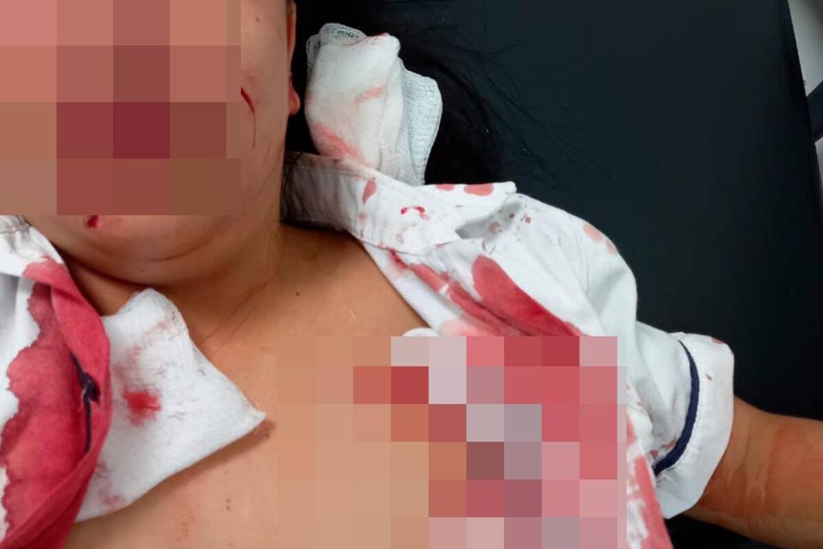 Turbaco: Niña agredió a compañera de clases con cuchilla y le causó heridas