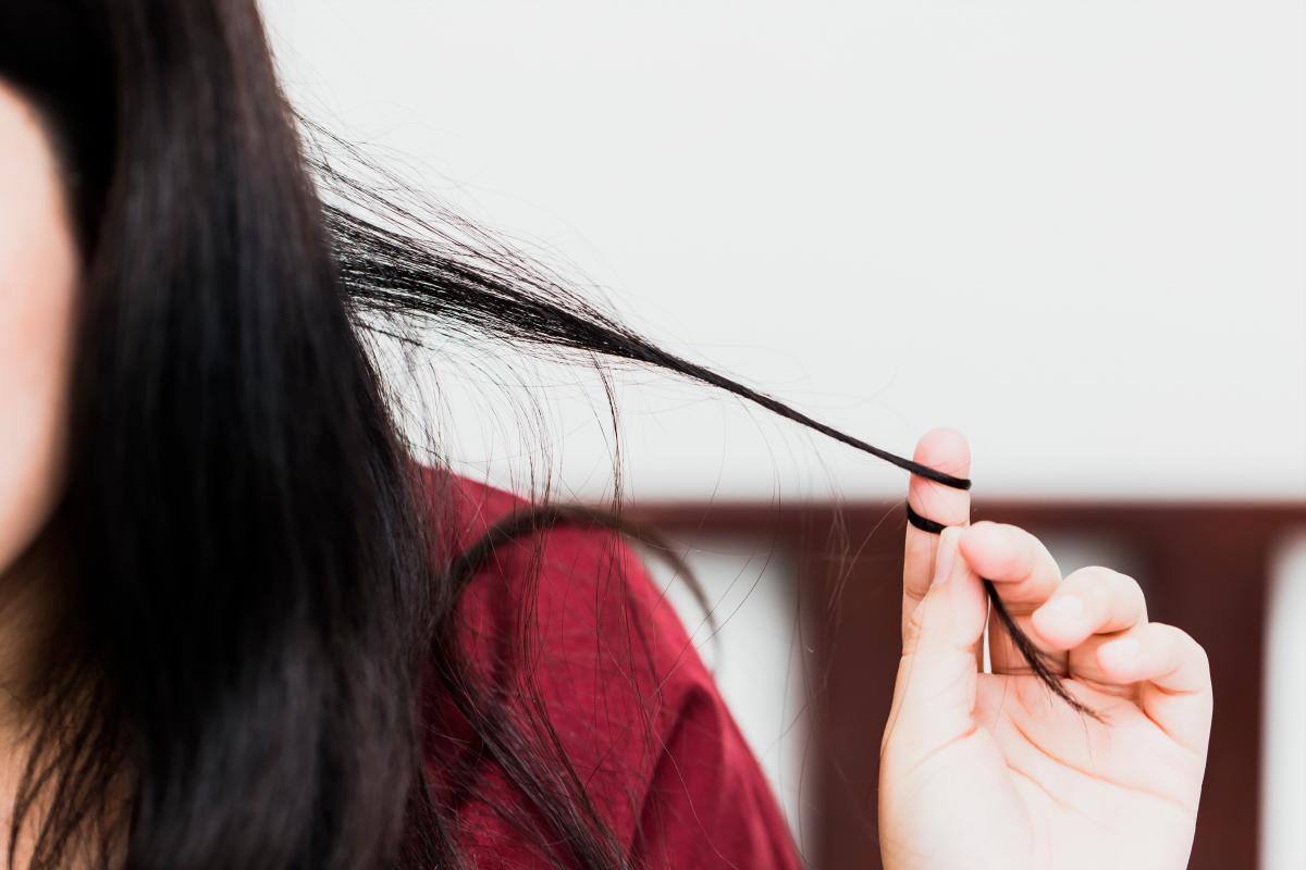 ¿Te gusta jalarte el cabello hasta arrancarlo? Podrías tener este trastorno