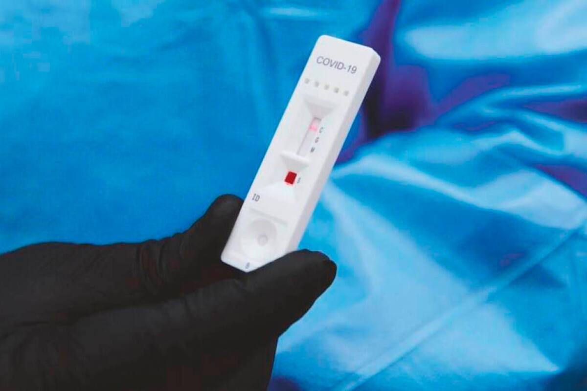 Procuraduría profirió cargos a William Dau por compra de pruebas COVID