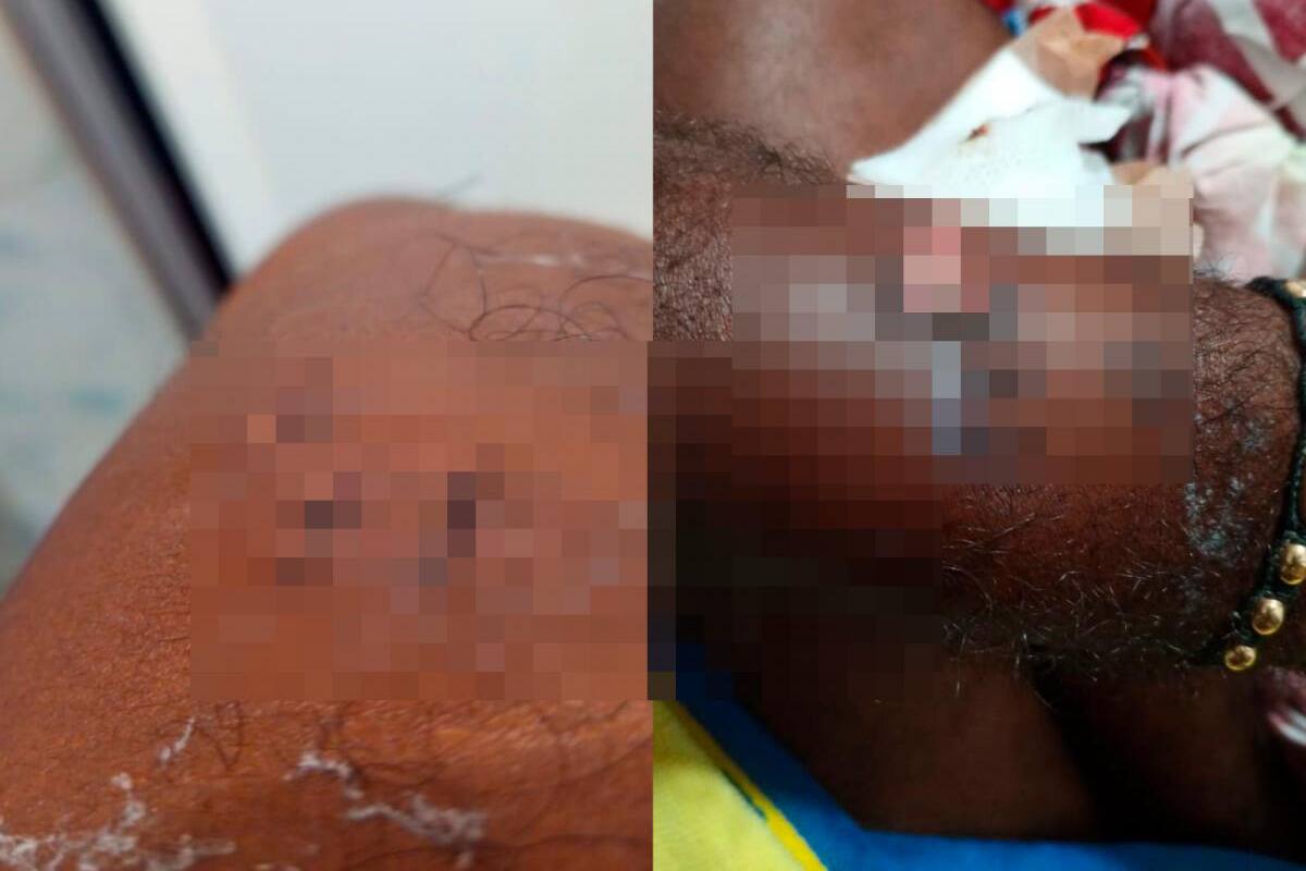 Con pico de botella hieren a comerciante para quitarle su moto en Pasacaballos