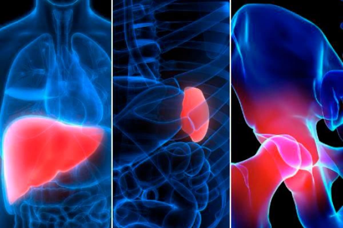 Enfermedad de Gaucher: 1 de cada 60.000 personas en el mundo la tienen