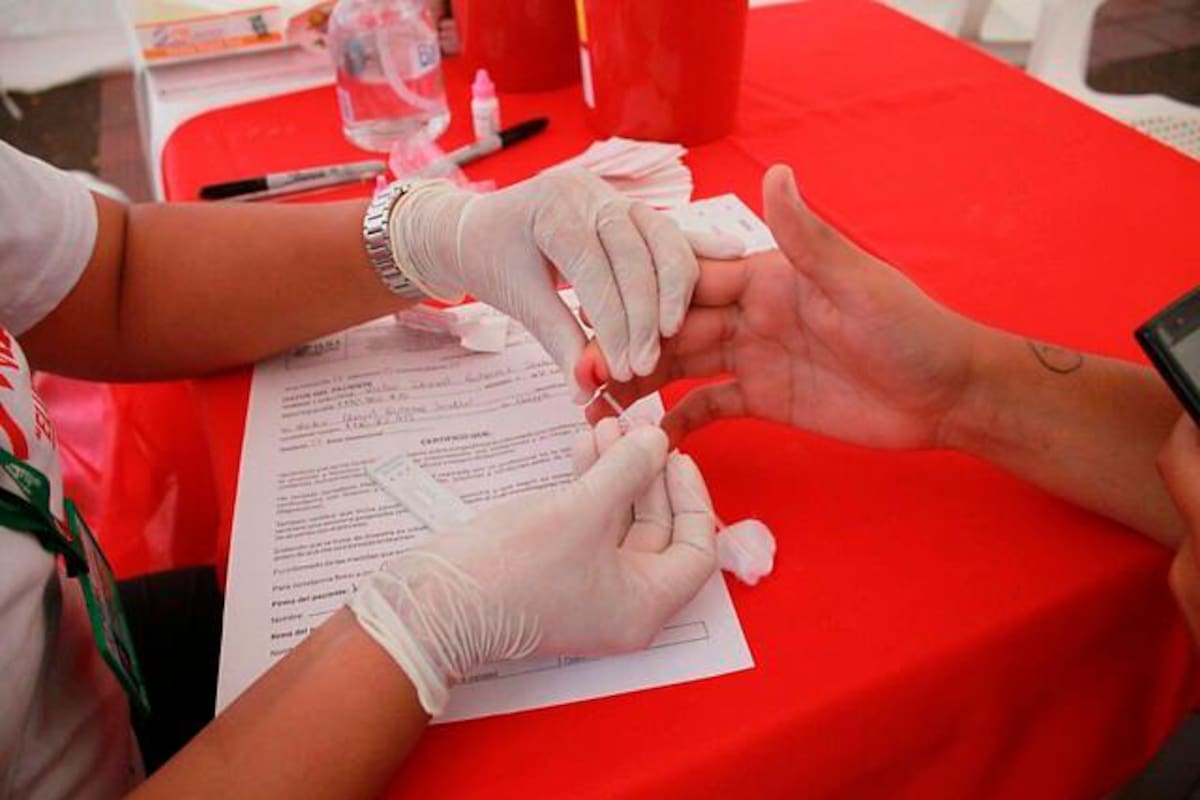 El VIH aumenta el riesgo de forma grave del COVID-19