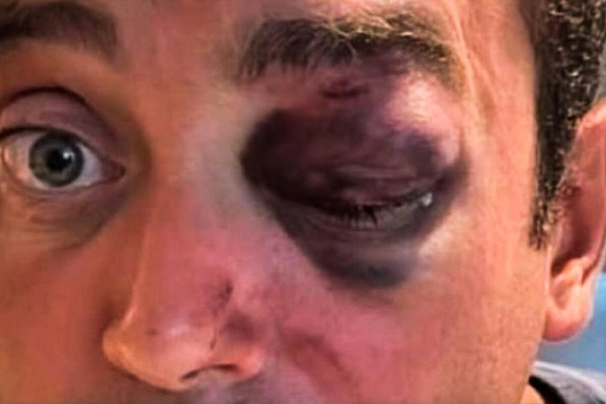 Video: Turista Italiano denuncia mala atención médica tras recibir fuerte golpiza