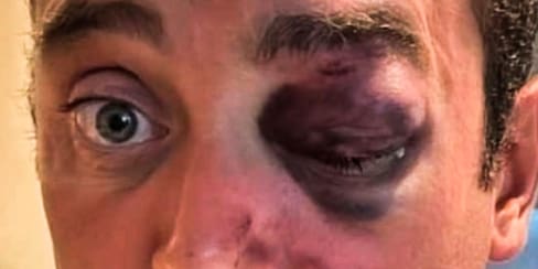Video: Turista Italiano denuncia mala atención médica tras recibir fuerte golpiza