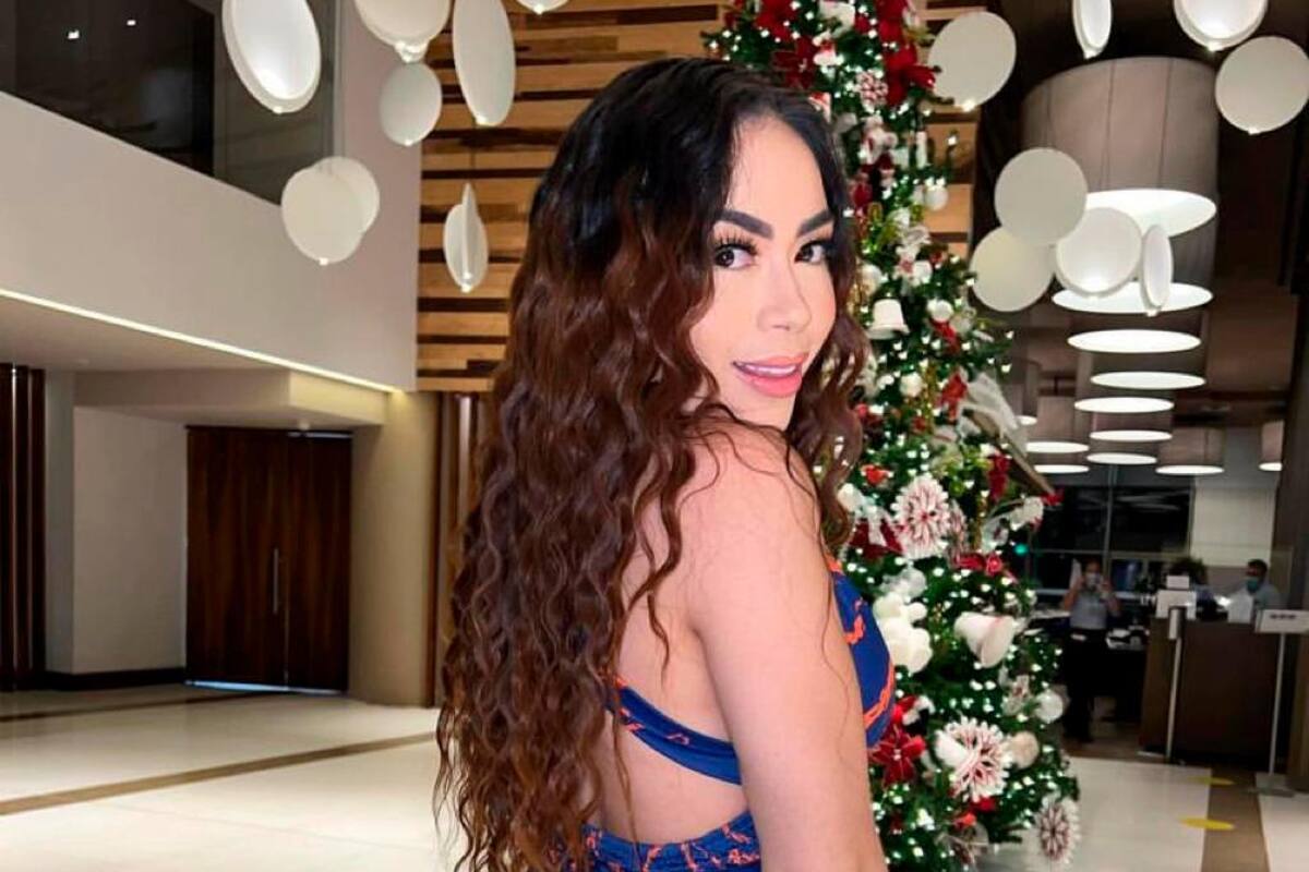 Otra polémica: Epa Colombia es acusada de “dejar calvas” a las personas