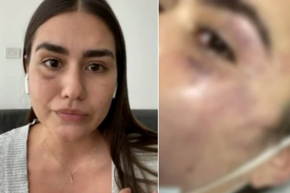 “El Estado me falló”: Diseñadora caleña denuncia que su agresor quedó libre