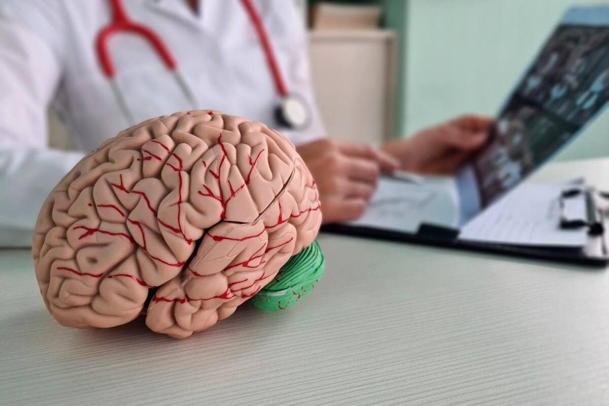 Derrame cerebral: 6 consejos para prevenir los accidentes cerebrovasculares
