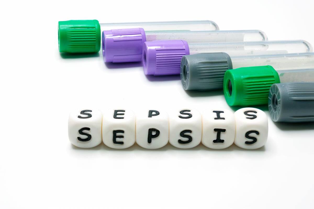 Sepsis, enfermedad que mata a cerca de un millón de recién nacidos al año