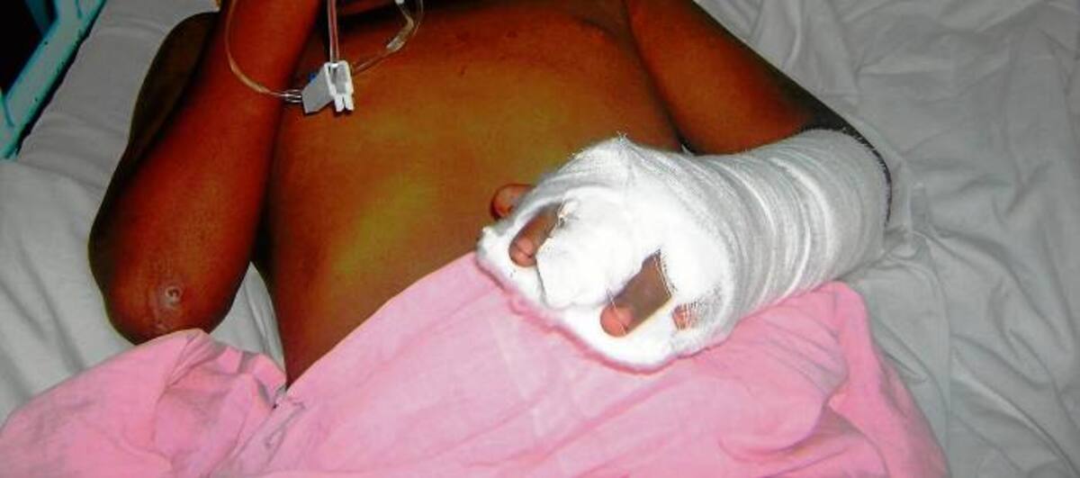 En la capital de Córdoba tres menores de edad debieron ser hospitalizados, después de jugar con elementos con pólvora en Montería.