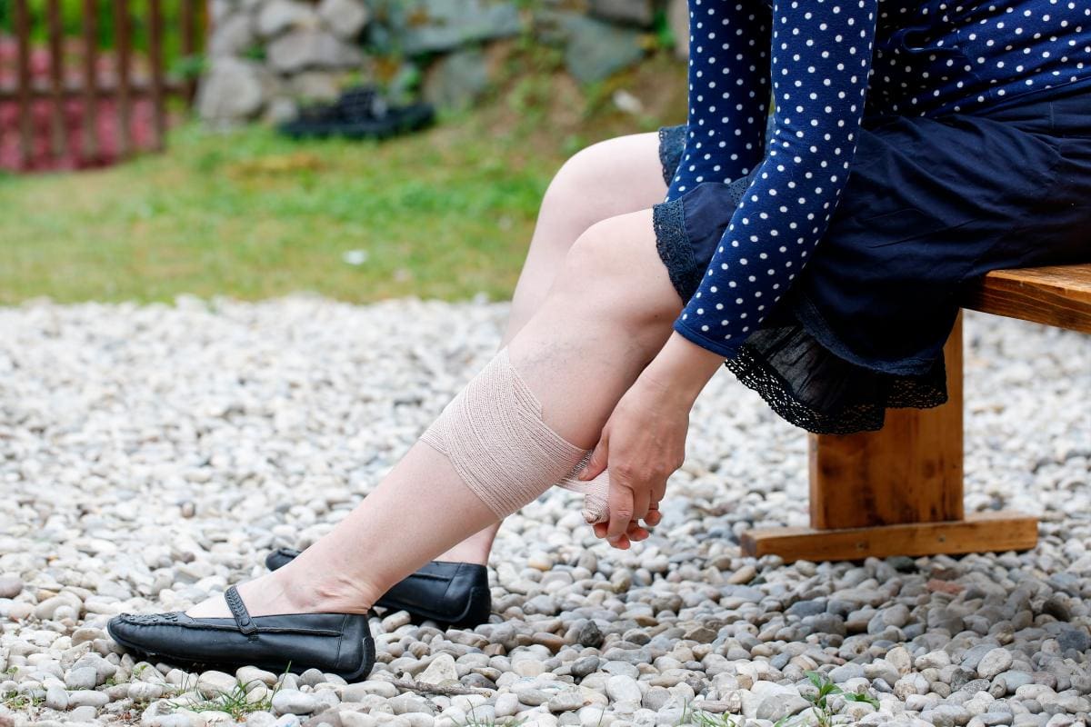 Entre los factores de riesgo están ser mayor de 60 años, sufrir una infección, tener obesidad, estrés y daño vascular (cirugía, trauma o fractura), uso de catéter o marcapasos.