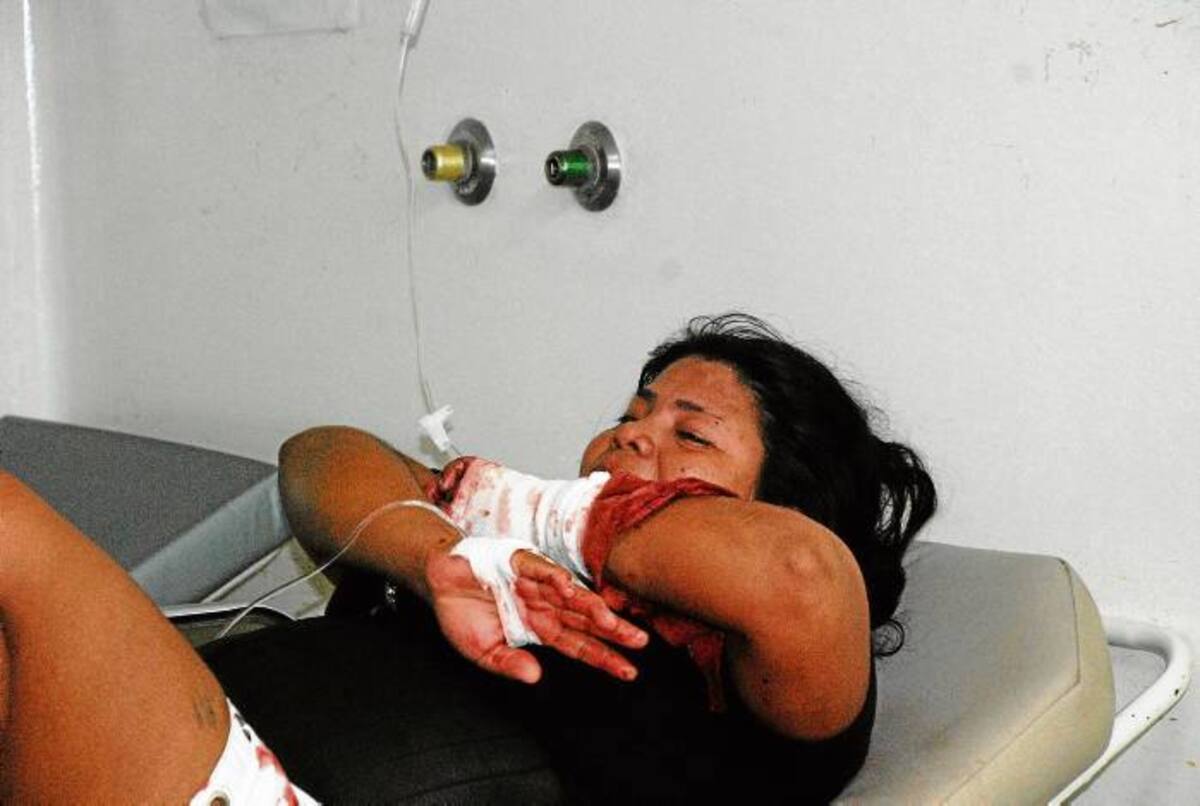 Isabel Álvarez Vergara, mujer lesionada.