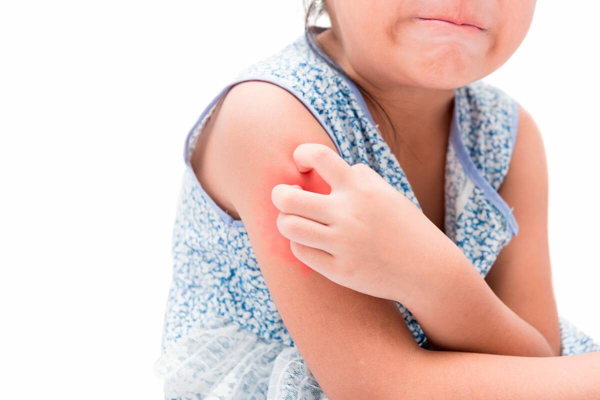Niña de 1 año está grave en UCI porque mamá la bañó con antiparasitario de vacas
