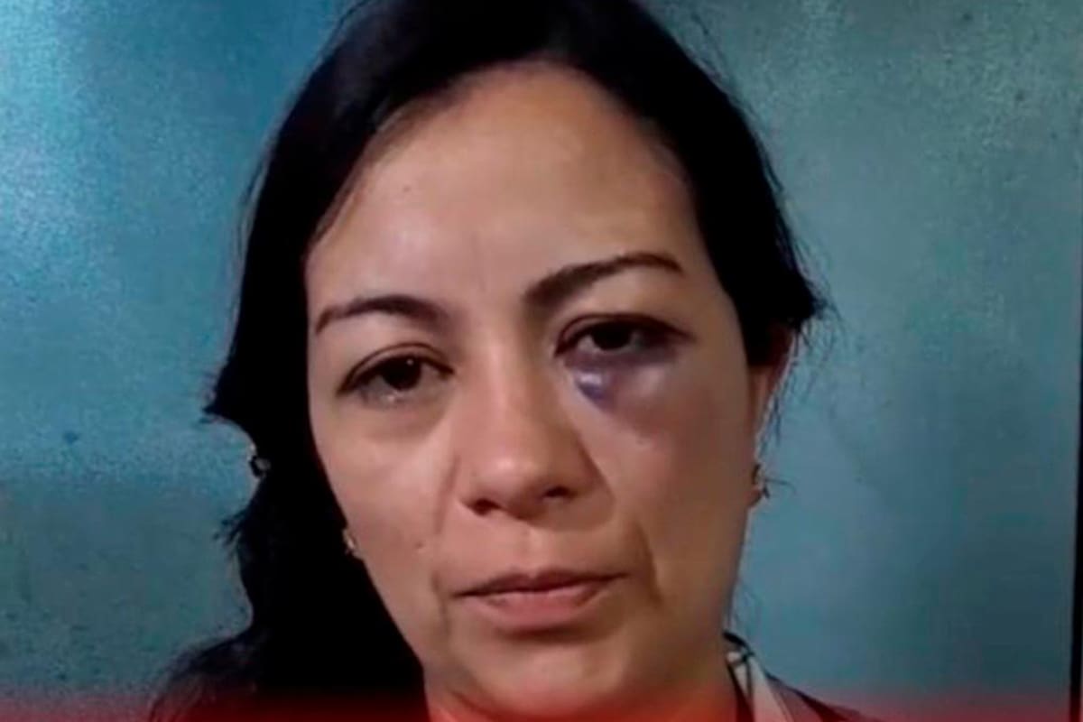 Profesora fue golpeada por una estudiante tras intentar decomisarle el celular