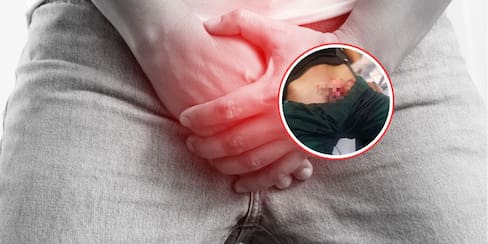 ¡Impactante! Mujer emborrachó a su pareja y le cortó el pene tras infidelidad