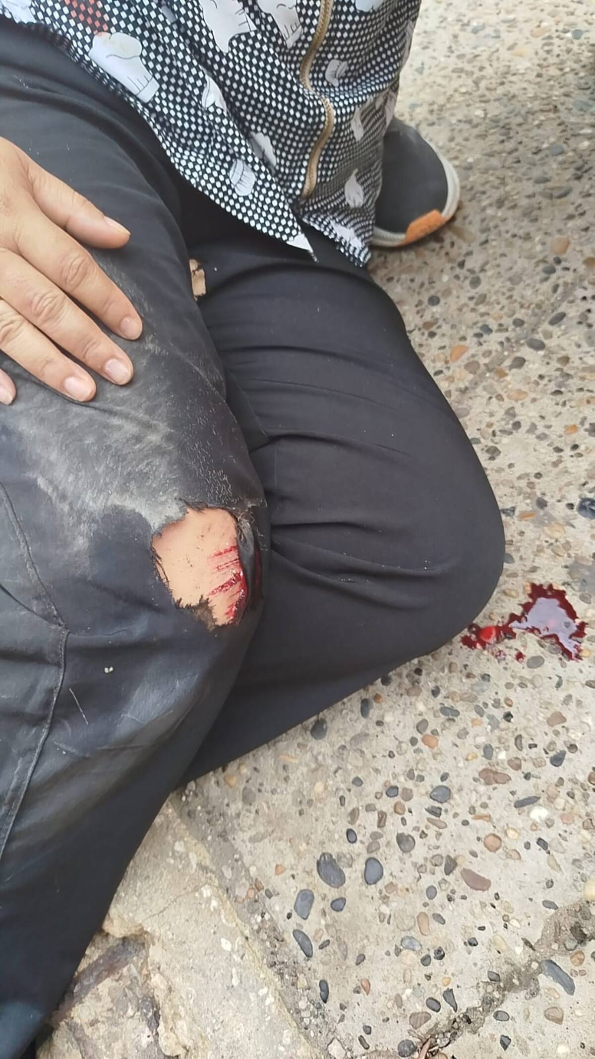Accidente de Transcaribe.