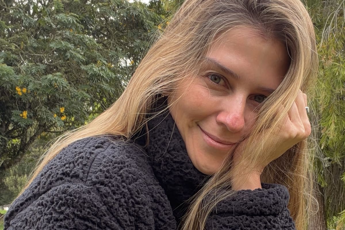 Andrea Guerrero revela que está libre de cáncer y mostró su cicatriz tras superarlo