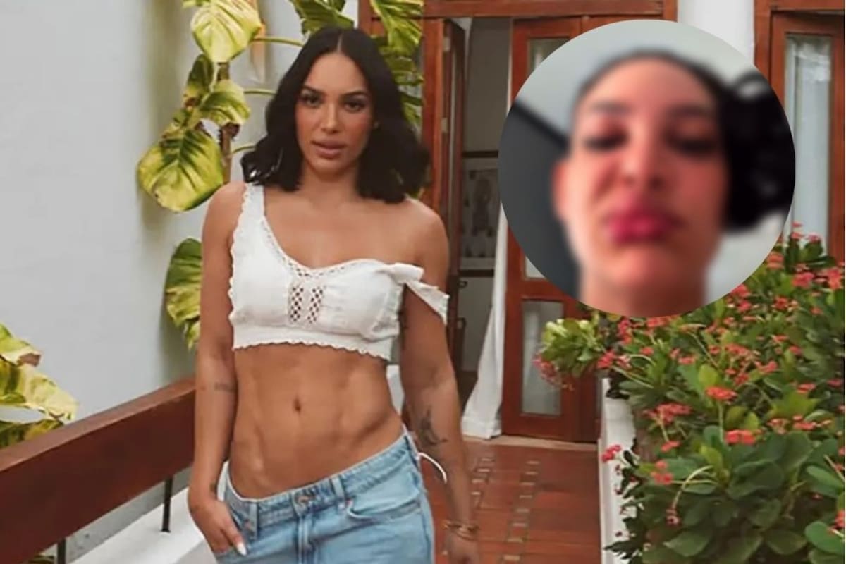 Impactantes fotos: Andrea Valdiri muestra su cuerpo tras fuerte alergia