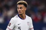 Estados Unidos le responde a Alemania con una joya de Robinson