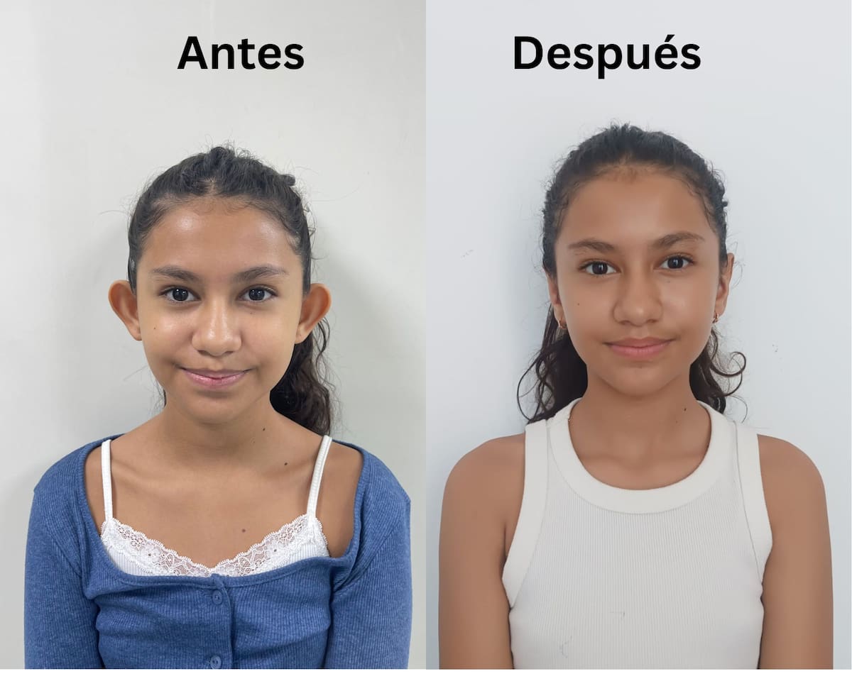 Menores de edad pueden realizarse la armonización de orejas, con autorización y acompañamiento de sus padres. //123RF.