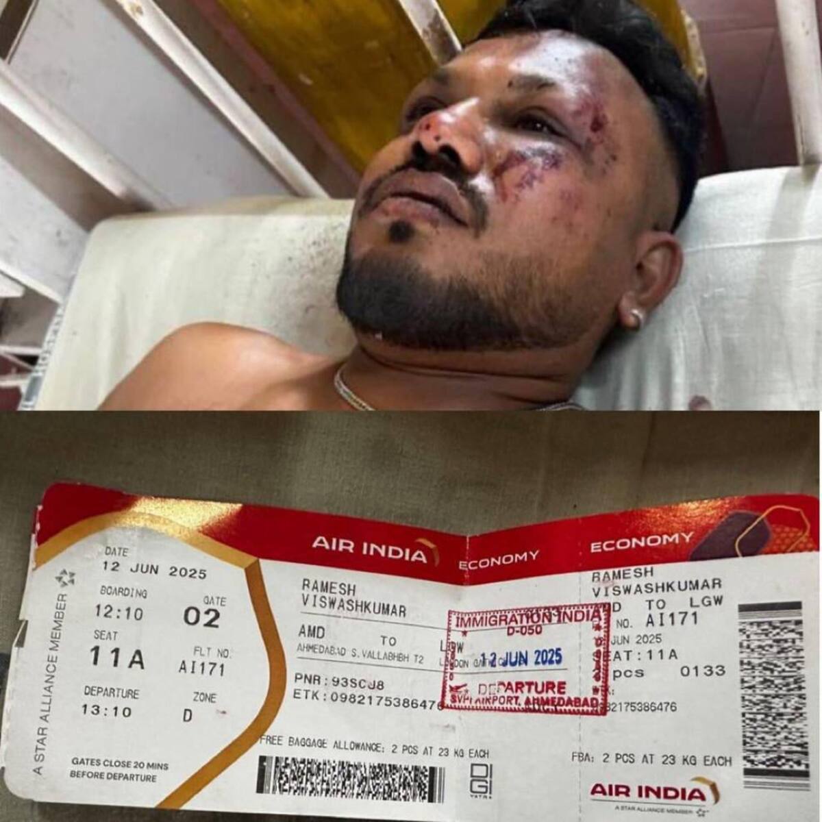 El sobreviviente del accidente en la India. // Foto: tomada de X