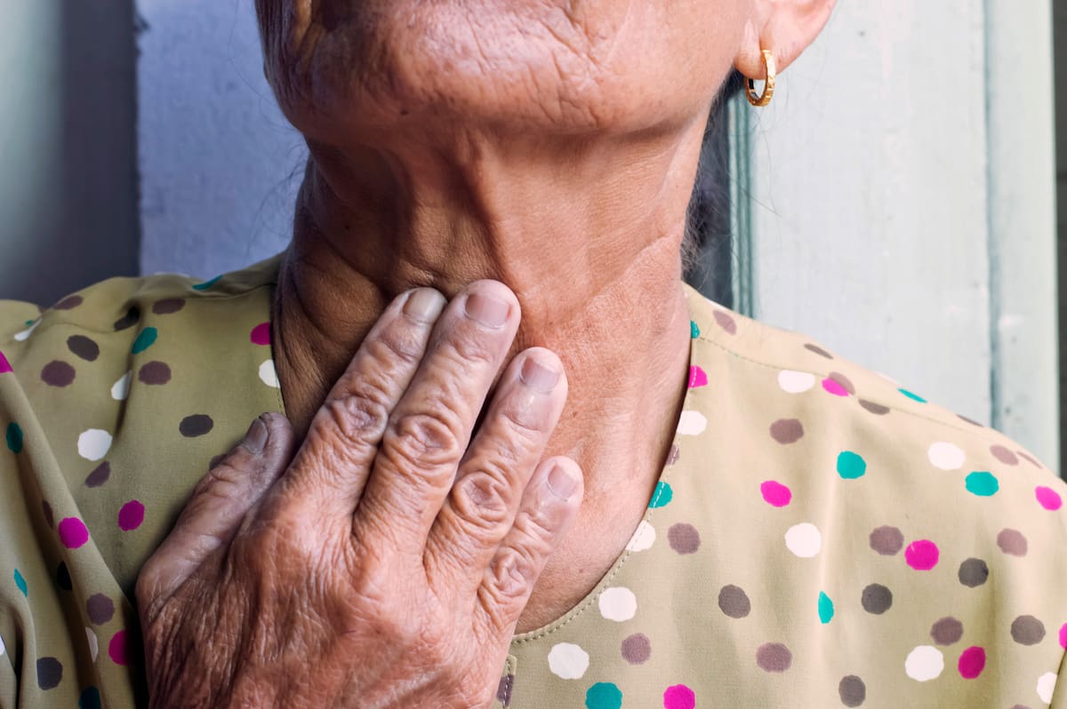 Alrededor de un 60% de los casos de cáncer de cabeza y cuello en el mundo son detectados en etapas avanzadas. //Foto: 123RF.