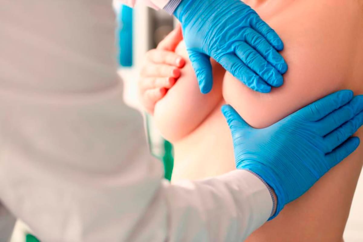 Cáncer de mama: ¿por qué la discriminación es un factor de mortalidad?