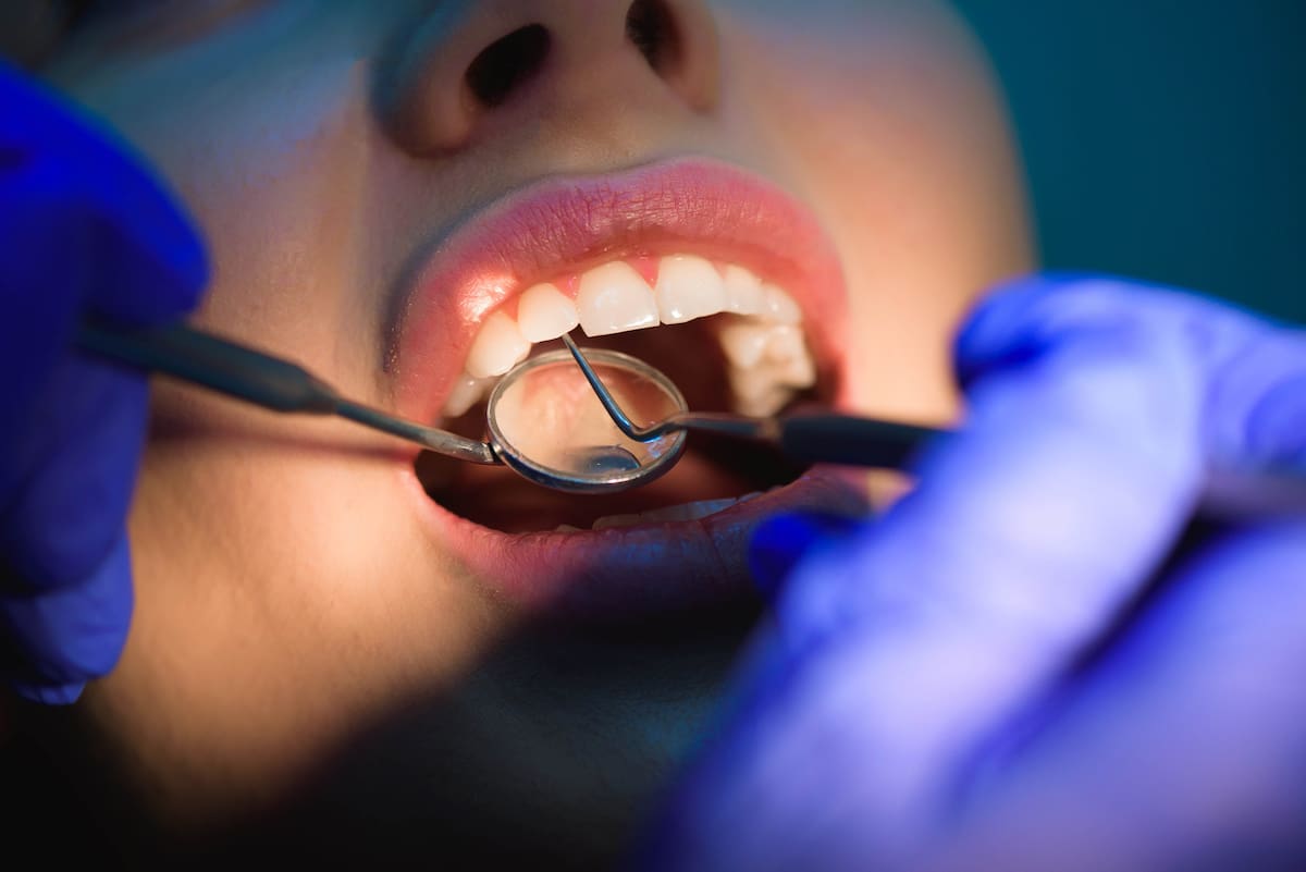 Es clave tratar la salud oral desde la prevención más que desde el tratamiento y así disminuir la carga de enfermedades como las caries. //123RF.