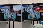 Así fue la primera cirugía a distancia desde Colombia a un paciente en India