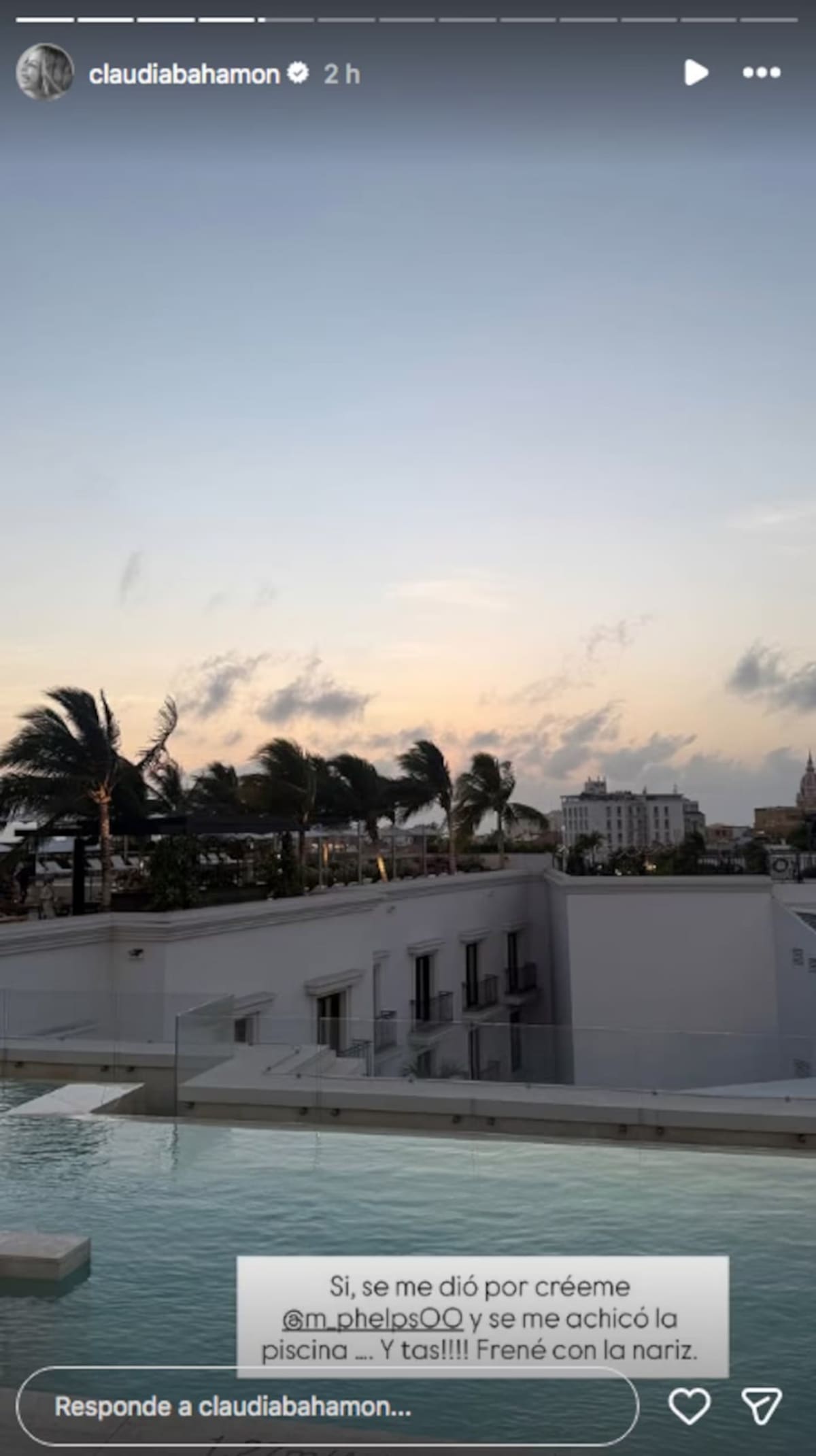 Claudia Bahamón compartió el accidente que tuvo durante sus vacaciones en Santa Marta. //Foto: IG @claudiabahamon.