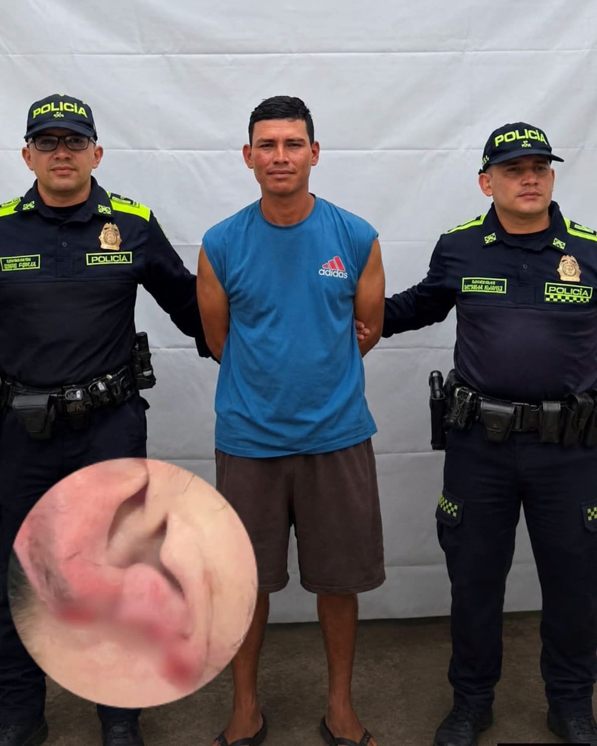 Cristian David Yáñez Torres, de 26 años, por su presunta responsabilidad en agredir a un integrante de la Policía Nacional.