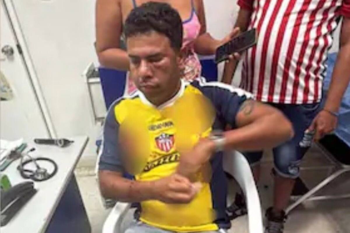 Exjugador campeón con Junior, sufre heridas en el rostro durante una riña