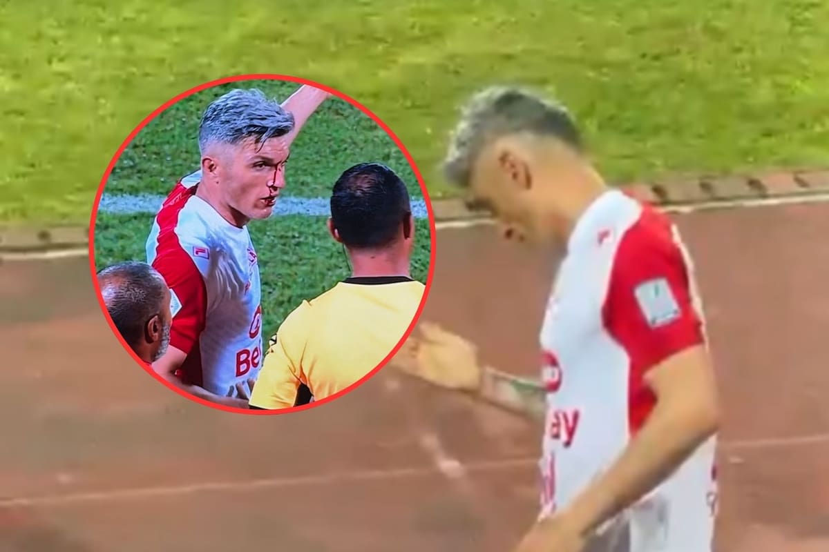 Lanzan objeto y lastiman a Daniel Torres en el partido entre DIM y Santa Fe: video es viral