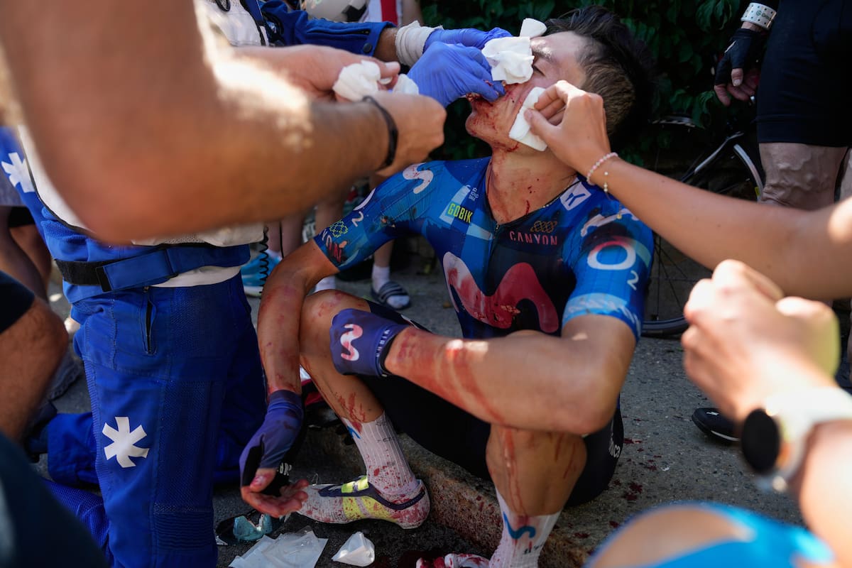 El colombiano Einer Rubio recibe atención médica durante la decimonovena etapa de la carrera ciclista del Tour de Francia, con salida en Gap y llegada en Alpe d'Huez (Francia). //Foto, AP: Mosa'ab Elshamy
